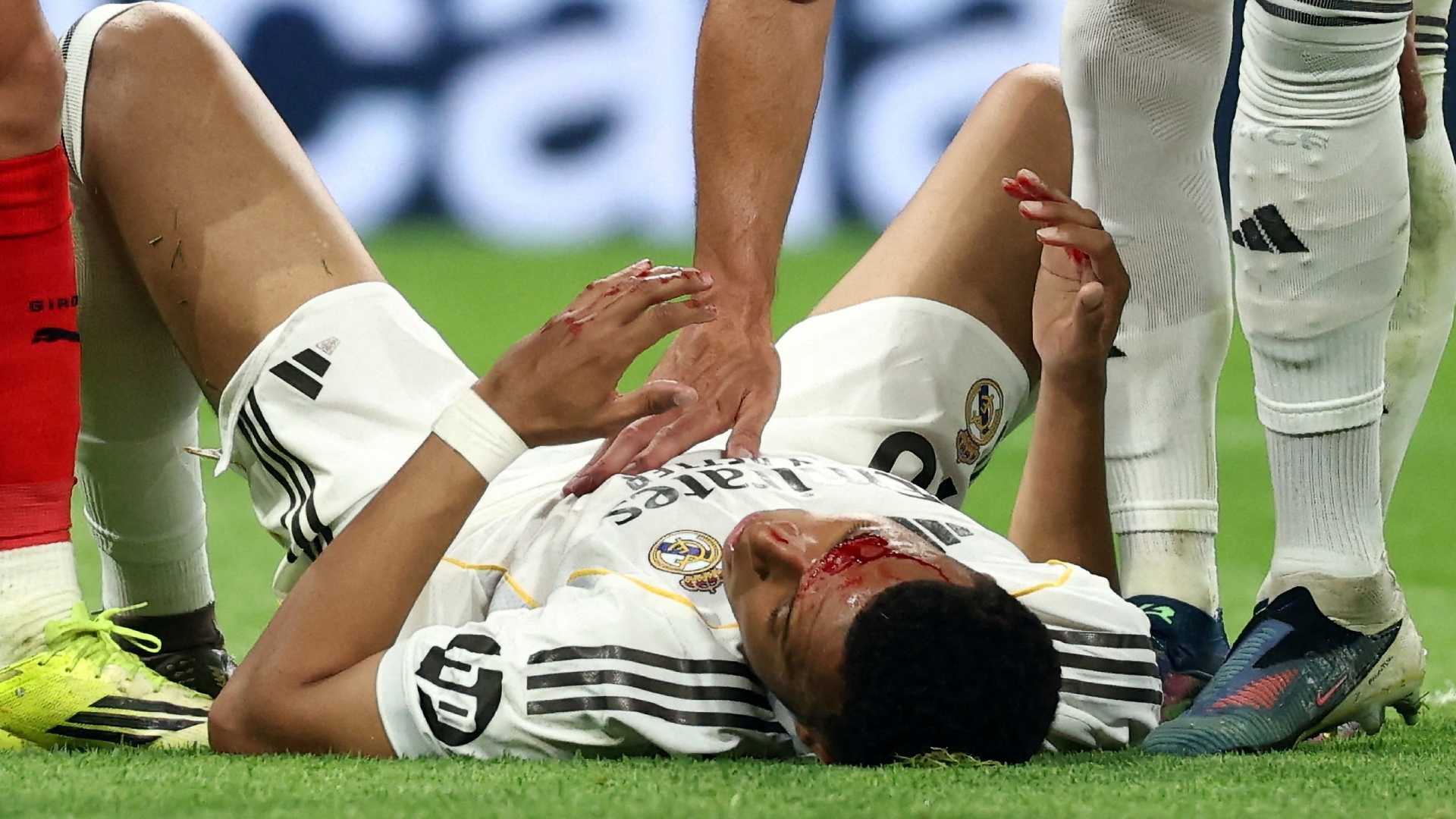 Mbappé lesion